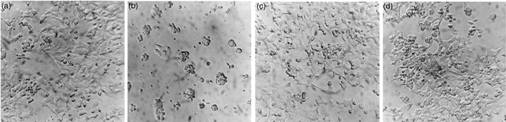 Neuroblastome cells-Galectins